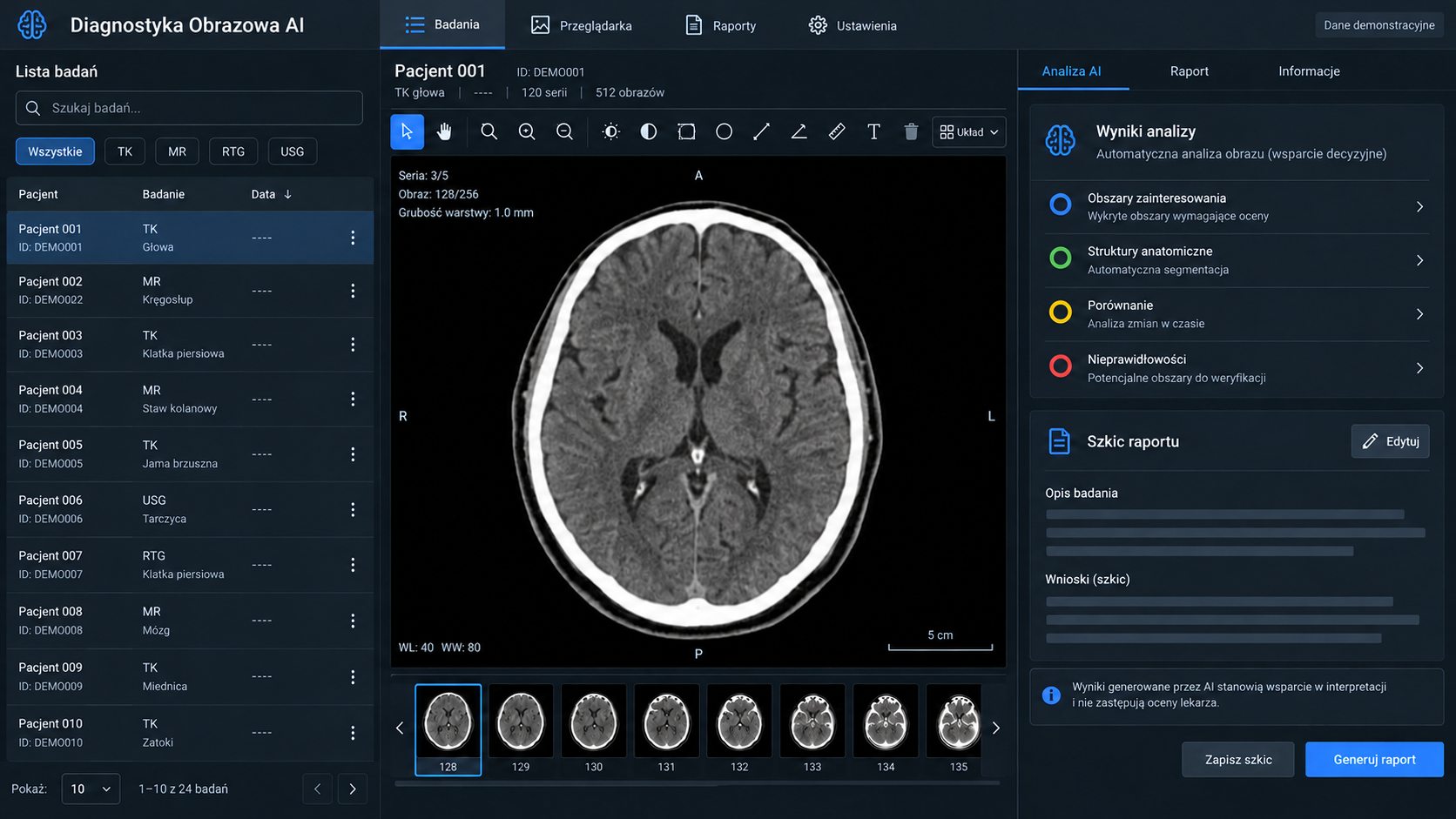 AI Imaging Diagnostics